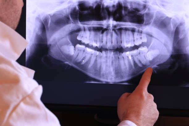 Best Knocked-Out Tooth Emergency  in Abbeville, SC