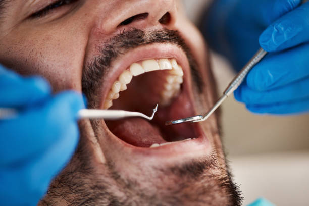 Tooth Infection Emergency Dentist in SC