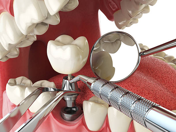 Best Cracked Tooth Emergency Dentist  in Abbeville, SC